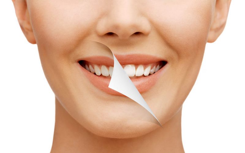 کارت تخفیف دندانپزشکی