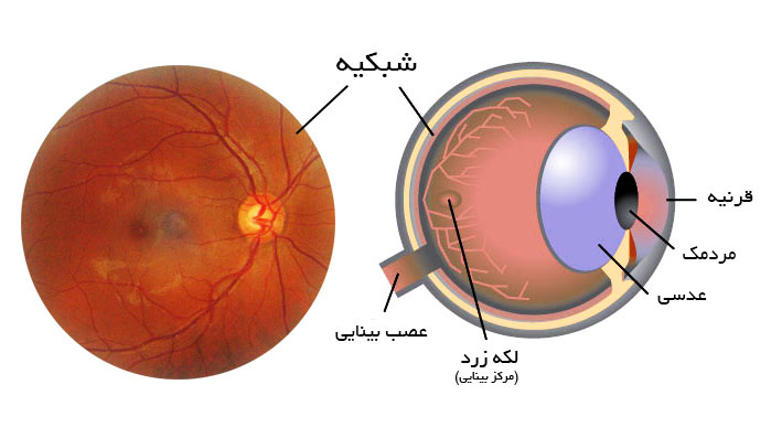 شبکیه چشم